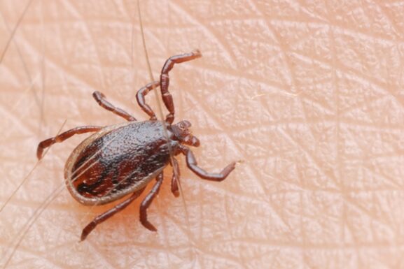 tick removal