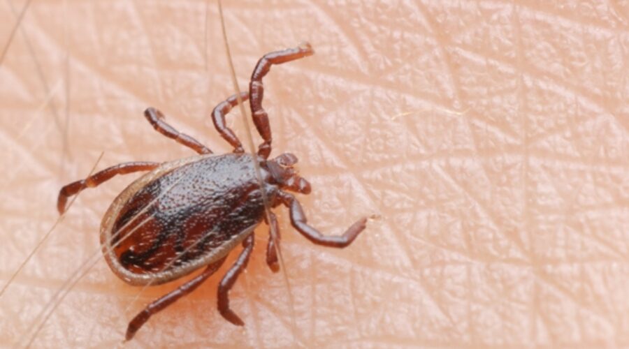 How to Safely Remove Ticks